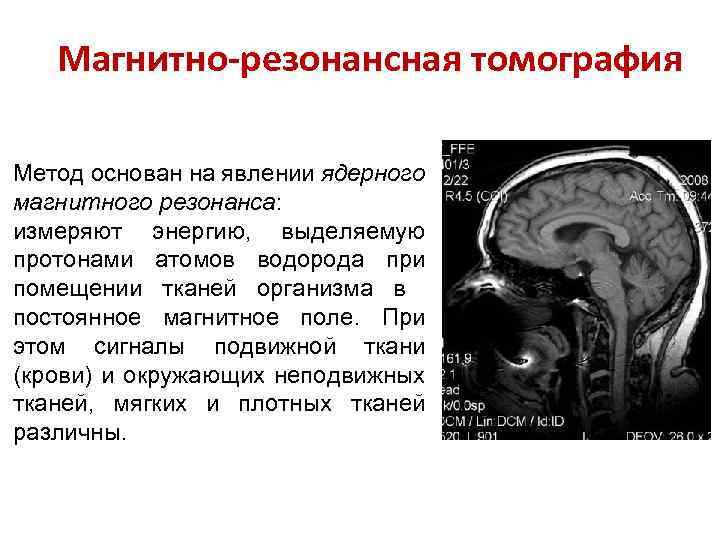 Магнитно-резонансная томография Метод основан на явлении ядерного магнитного резонанса: измеряют энергию, выделяемую протонами атомов