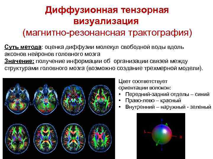 Диффузная структура. Тензорная трактография. Диффузионно тензорная визуализация. Магнитно резонансная трактография. Визуализация магнитно-резонансных изображений.