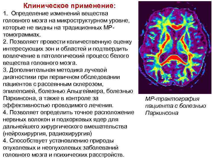 Клиническое применение: 1. Определение изменений вещества головного мозга на микроструктурном уровне, которые не видны