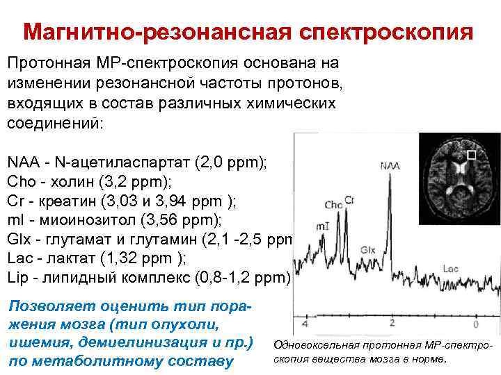 Магнитно-резонансная спектроскопия Протонная МР-спектроскопия основана на изменении резонансной частоты протонов, входящих в состав различных