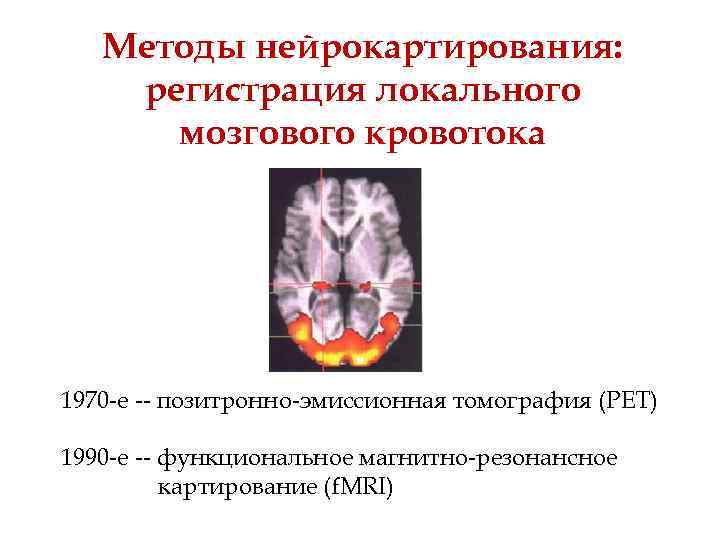 Методы нейрокартирования: регистрация локального мозгового кровотока 1970 -е -- позитронно-эмиссионная томография (PET) 1990 -е