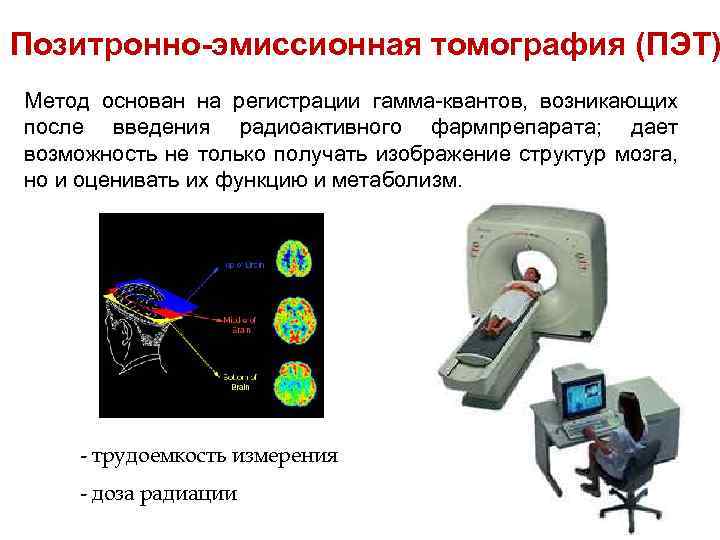 Позитронно-эмиссионная томография (ПЭТ) Метод основан на регистрации гамма-квантов, возникающих после введения радиоактивного фармпрепарата; дает