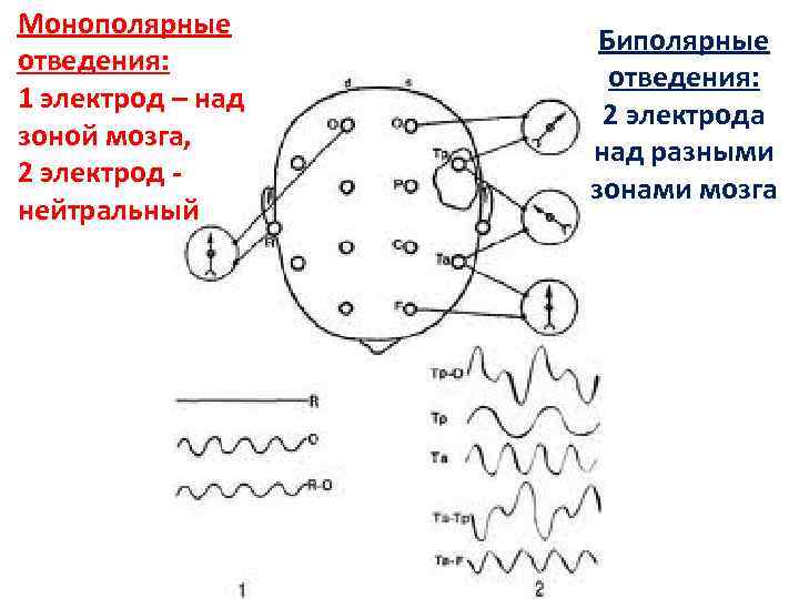 Электроды ээг схема