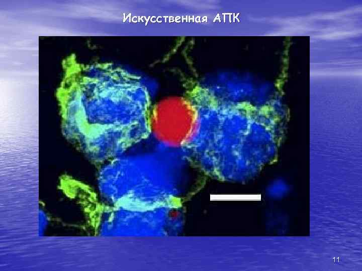 Искусственная АПК 11 