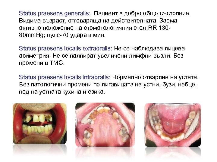 Status praesens generalis: Пациент в добро общо състояние. Видима възраст, отговаряща на действителната. Заема