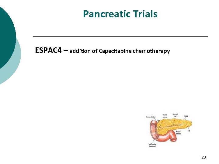 Pancreatic Trials ESPAC 4 – addition of Capecitabine chemotherapy 28 