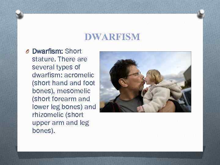 DWARFISM O Dwarfism: Short stature. There are several types of dwarfism: acromelic (short hand