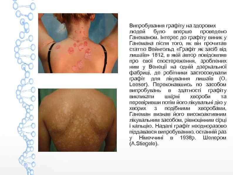 Випробування графіту на здорових людей було вперше проведено Ганеманом. Інтерес до графіту виник у