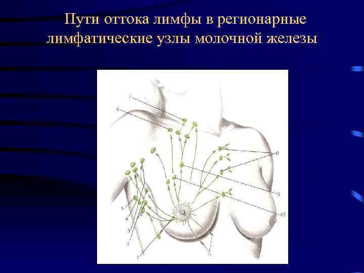  Пути оттока лимфы в регионарные лимфатические узлы молочной железы 