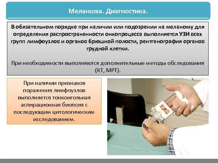 Меланома. Диагностика. В обязательном порядке при наличии или подозрении на меланому для определения распространенности