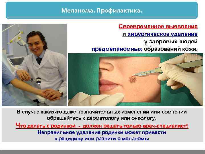 Меланома. Профилактика. Своевременное выявление и хирургическое удаление у здоровых людей предмеланомных образований кожи В