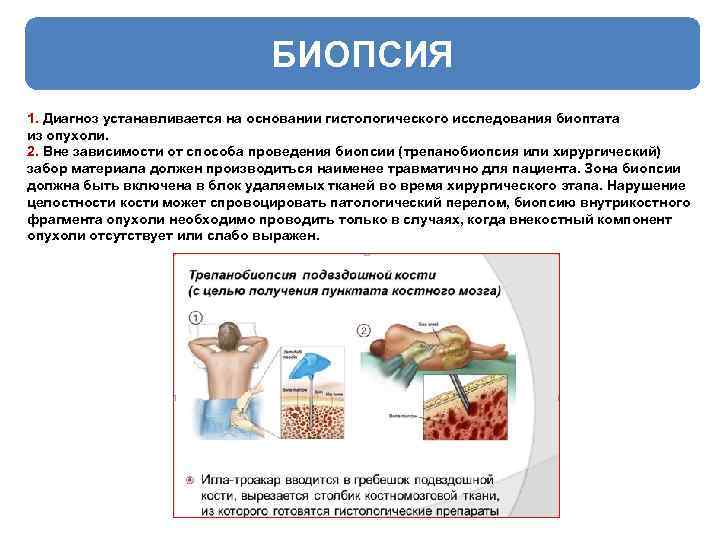 БИОПСИЯ 1. Диагноз устанавливается на основании гистологического исследования биоптата из опухоли. 2. Вне зависимости