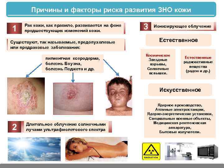 Причины и факторы риска развития ЗНО кожи 1 Рак кожи, как правило, развивается на