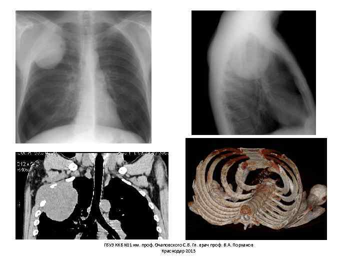 ГБУЗ ККБ № 1 им. проф. Очаповского С. В. Гл. врач проф. В. А.