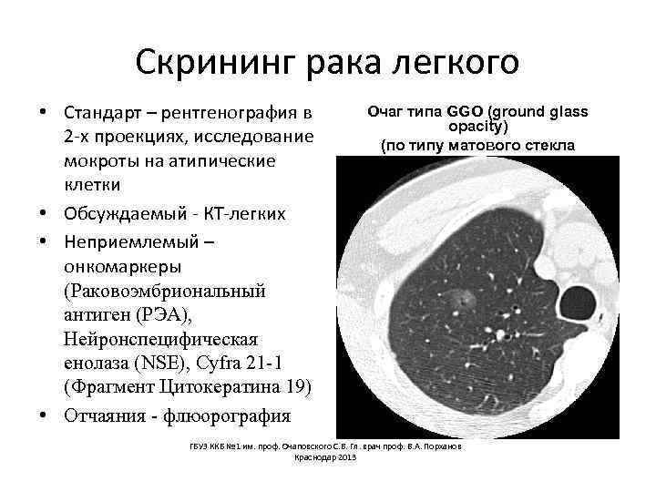 Как избавиться от мокроты в легких