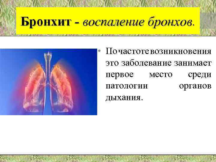 Бронхит - воспаление бронхов. • По частоте возникновения это заболевание занимает первое место среди