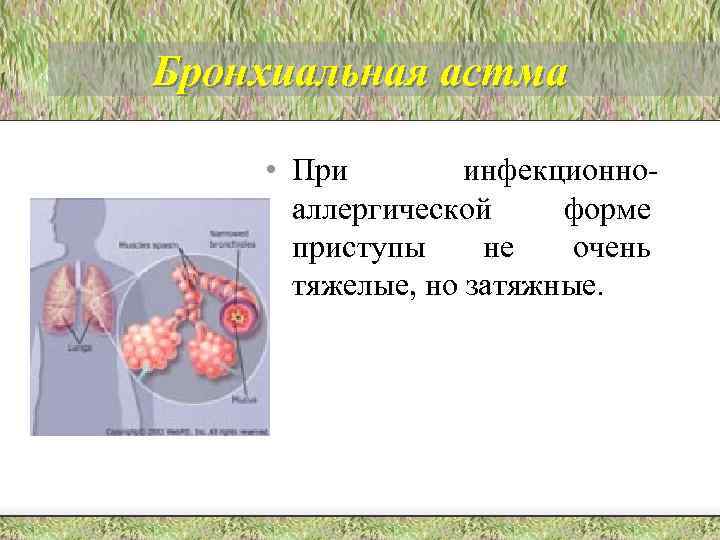 Бронхиальная астма • При инфекционноаллергической форме приступы не очень тяжелые, но затяжные. 