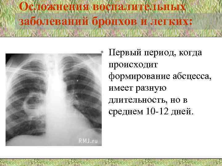 Осложнения воспалительных заболеваний бронхов и легких: • Первый период, когда происходит формирование абсцесса, имеет