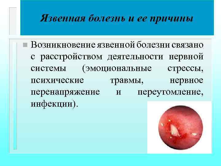 Язвенная болезнь и ее причины n Возникновение язвенной болезни связано с расстройством деятельности нервной