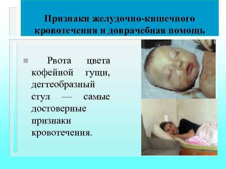 Признаки желудочно-кишечного кровотечения и доврачебная помощь n Рвота цвета кофейной гущи, дегтеобразный стул —