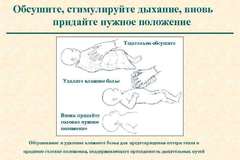 Обсушите, стимулируйте дыхание, вновь придайте нужное положение Тщательно обсушите Удалите влажное белье Вновь придайте