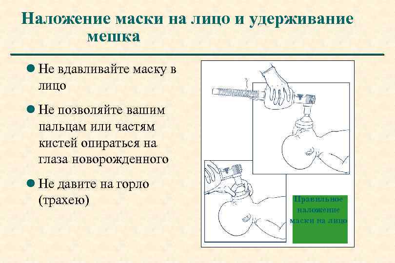 Наложение маски на лицо и удерживание мешка l Не вдавливайте маску в лицо l