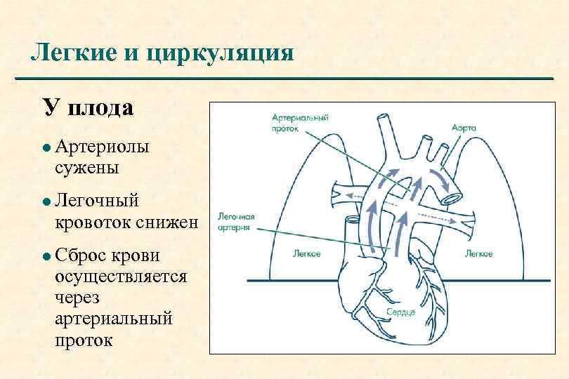 Схема открытого артериального протока