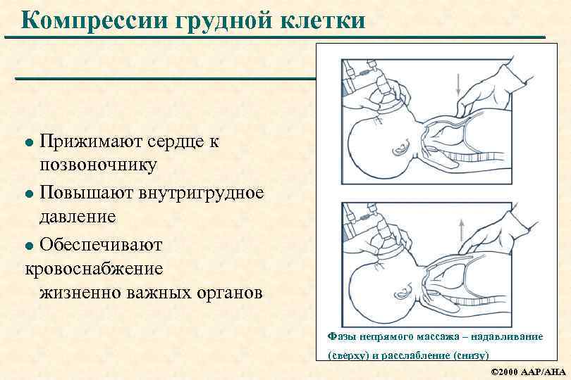 Компрессии грудной клетки Прижимают сердце к позвоночнику l Повышают внутригрудное давление l Обеспечивают кровоснабжение