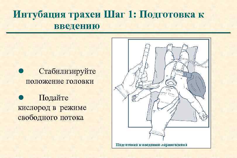 Интубация трахеи Шаг 1: Подготовка к введению l Стабилизируйте положение головки l Подайте кислород