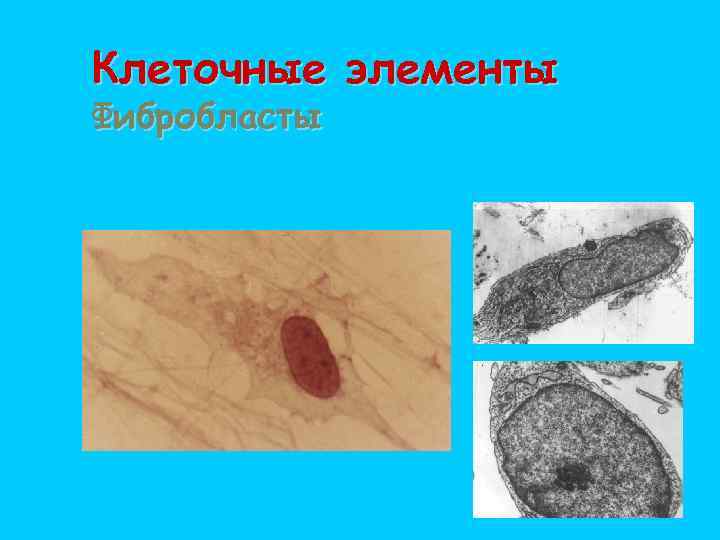 Клеточные элементы Фибробласты 