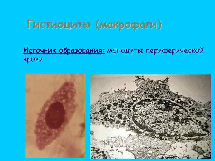 Гистиоциты (макрофаги) Источник образования: моноциты периферической крови 