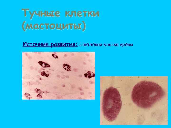 Тучные клетки (мастоциты) Источник развития: стволовая клетка крови 