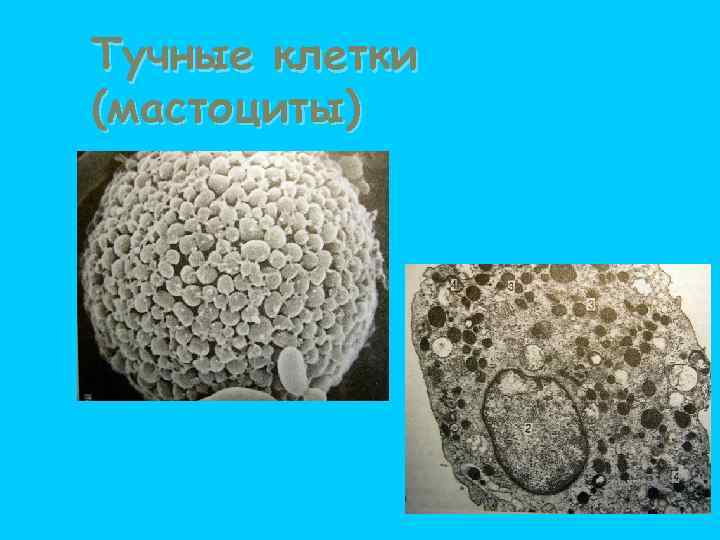 Тучные клетки (мастоциты) 