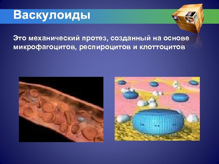 Васкулоиды Это механический протез, созданный на основе микрофагоцитов, респироцитов и клоттоцитов 