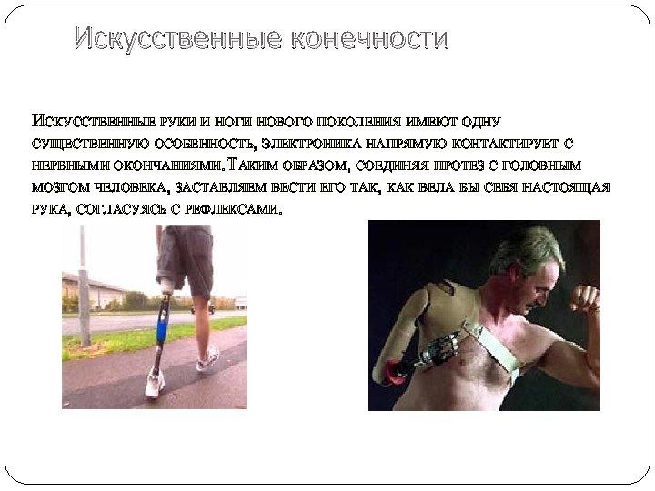 Искусственные конечности ИСКУССТВЕННЫЕ РУКИ И НОГИ НОВОГО ПОКОЛЕНИЯ ИМЕЮТ ОДНУ СУЩЕСТВЕННУЮ ОСОБЕННОСТЬ, ЭЛЕКТРОНИКА НАПРЯМУЮ