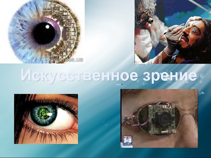Искусственное зрение 