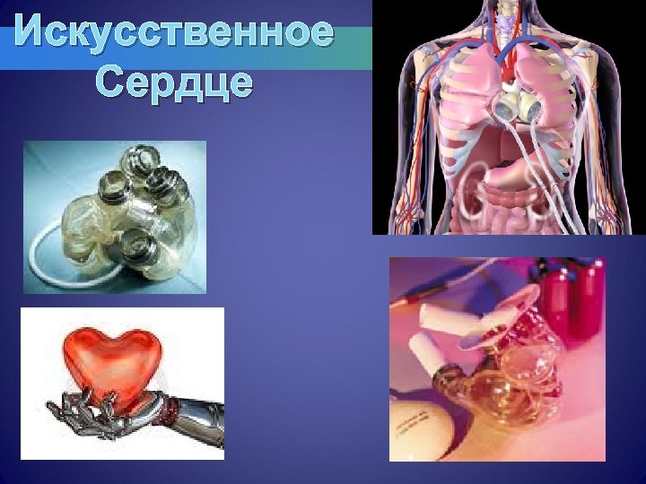 Презентация искусственное сердце