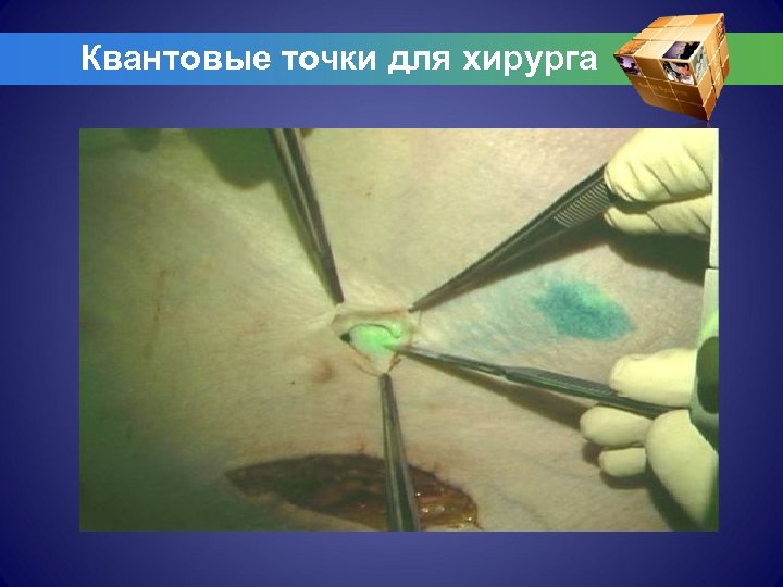 Квантовые точки для хирурга 