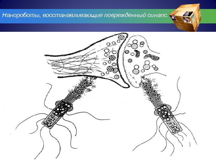 Нанороботы, восстанавливающие поврежденный синапс. 