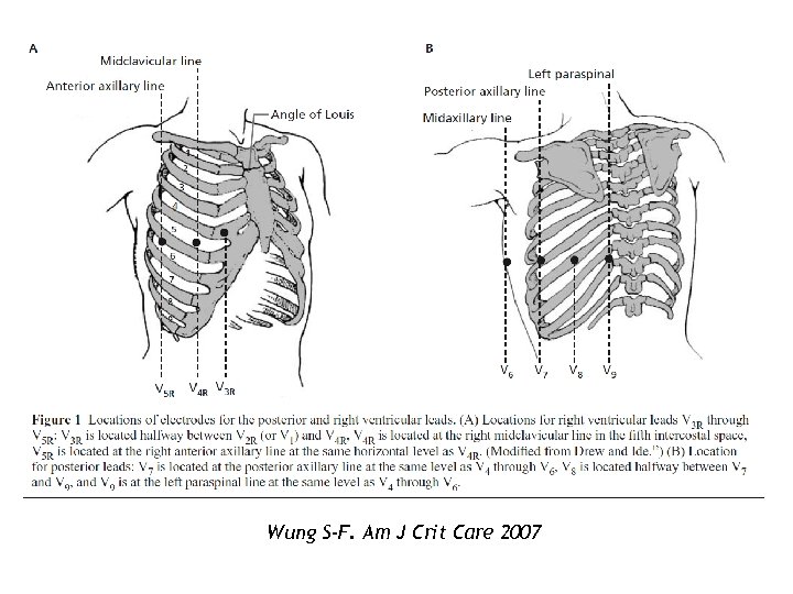 Wung S-F. Am J Crit Care 2007 