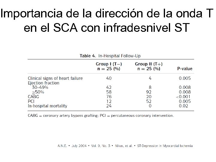 Importancia de la dirección de la onda T en el SCA con infradesnivel ST