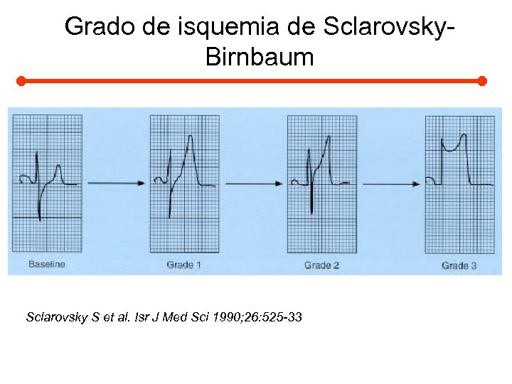 Grado de isquemia de Sclarovsky. Birnbaum Sclarovsky S et al. Isr J Med Sci