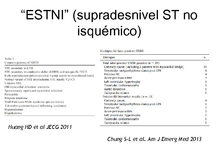 “ESTNI” (supradesnivel ST no isquémico) Huang HD et al JECG 2011 Chung S-L et