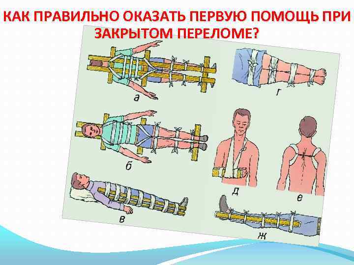 Первая помощь при переломах презентация 8 класс