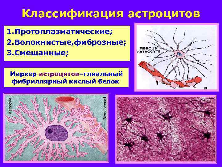 Классификация астроцитов 1. Протоплазматические; 2. Волокнистые, фиброзные; 3. Смешанные; Маркер астроцитов–глиальный фибриллярный кислый белок