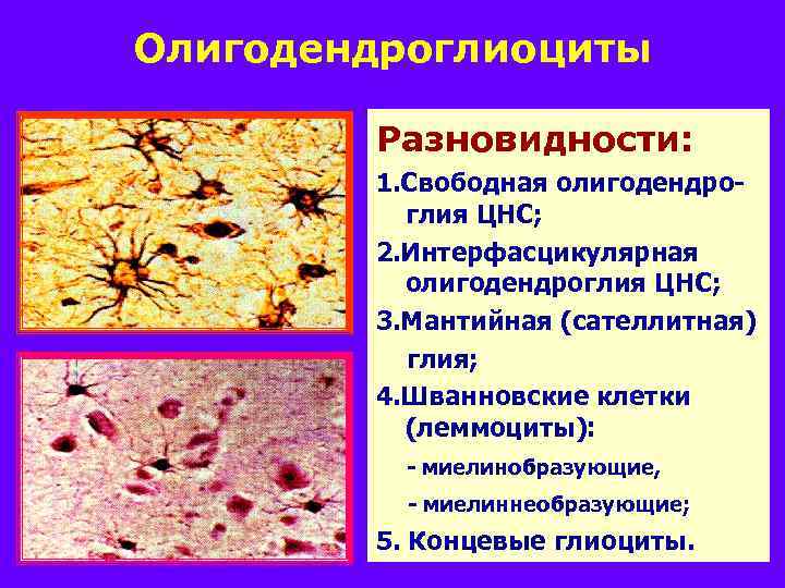 Олигодендроглиоциты Разновидности: 1. Свободная олигодендроглия ЦНС; 2. Интерфасцикулярная олигодендроглия ЦНС; 3. Мантийная (сателлитная) глия;