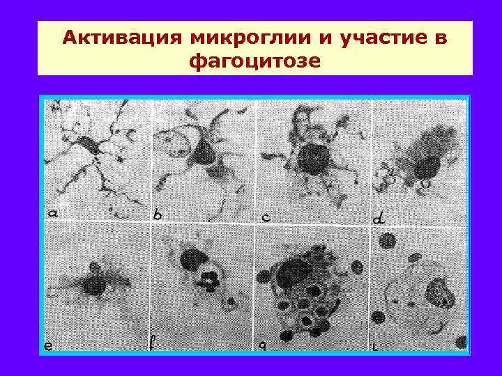 Активация микроглии и участие в фагоцитозе 