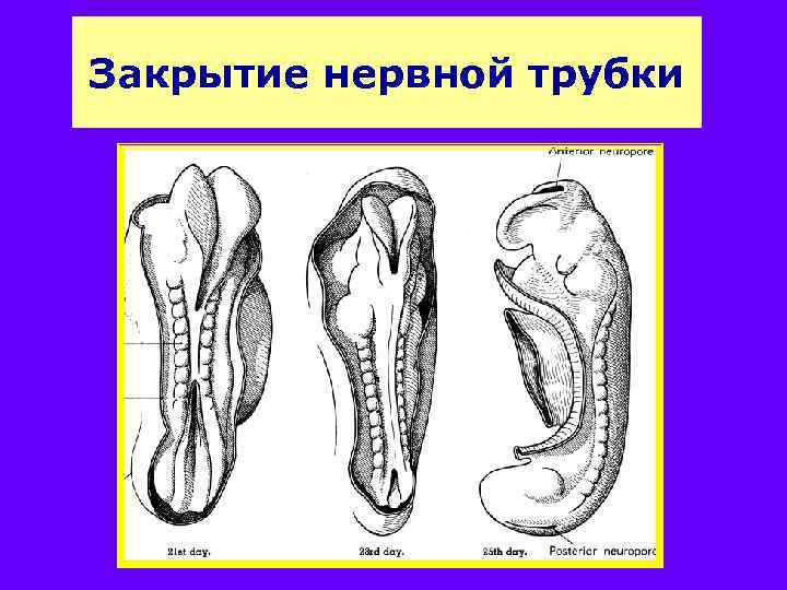 Закрытие нервной трубки 