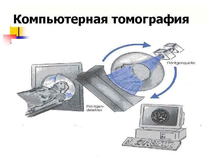 Компьютерная томография 
