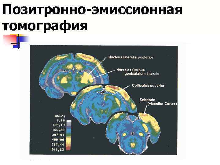 Позитронно-эмиссионная томография 
